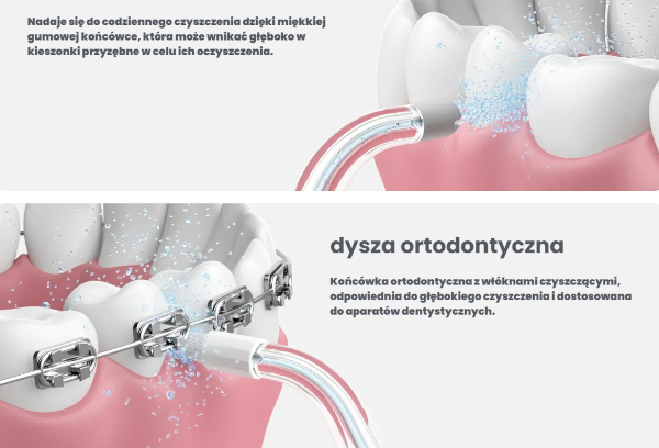 OCLEAN AirPump A10 końcówki do irygatora Oclean